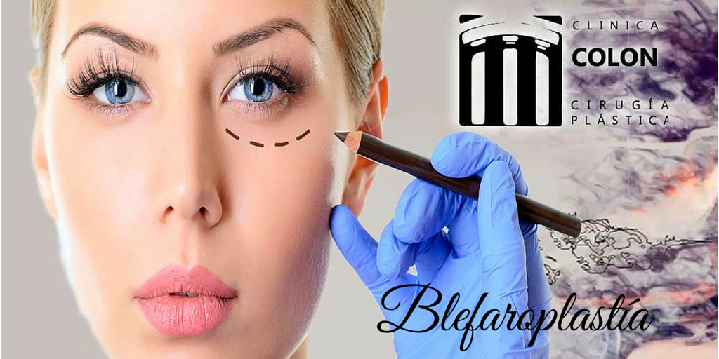 Blefaroplastia – Cirugía de parpados